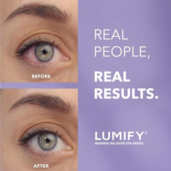 LUMIFY Redness Reliever Eye Drops, For Whiter & Brighter Looking Eyes, 0.08 Fl Oz (2.5 mL) - Image 4